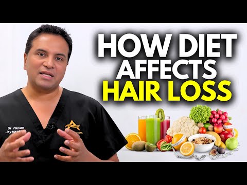 How Diet Affects Hair Loss