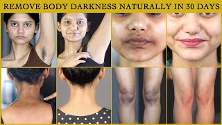 Get Rid of BODY BLACKNESS Naturally I 7 Days Natural UNDERARMS GLOW Cream |