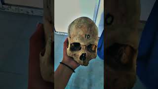 ADC😌♥️..... Dental Life #bdsshorts#dentico#bds#dream#dentallife