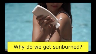Why do we get sunburned?