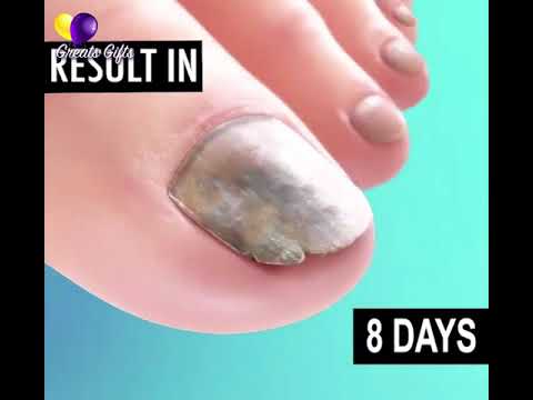 Nail Treatment Cream