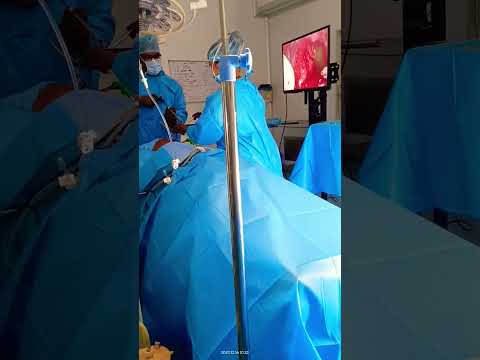 Video assisted thoracic surgery for tuberculosis  done under general anesthesia. #anesthesiology