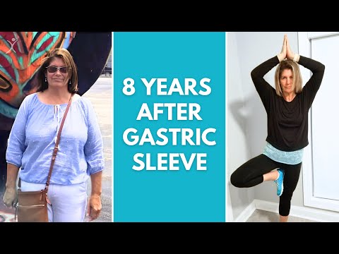 8 Years After Gastric Sleeve | Can You Stomach This? Episode 23