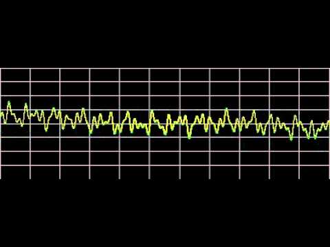 Cellulitis - Rife Frequencies