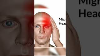 #Diseases of Aries Lagna #aries #mesha lagna #astrology #diseases #aries rising #mesha rashi