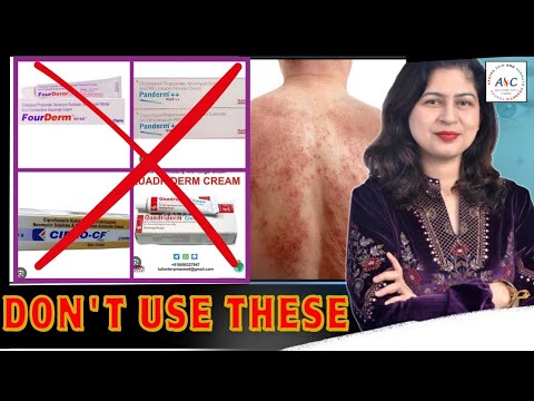 Steroid Abuse in Skin: Why You Should Avoid Steroid Creams for Fungal Infections | Dr. Cheena Langer