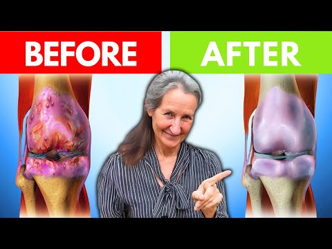 HEAL Joint Pain And Arthritis VERY FAST In 1 WEEK! | Barbara O'Neill