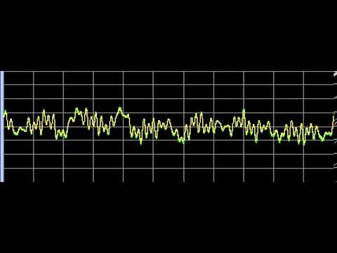 Breast Cancer - Rife Frequencies