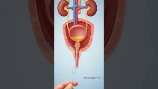 Acute Urinary Retention In Elderly: Causes, Tests & Treatment