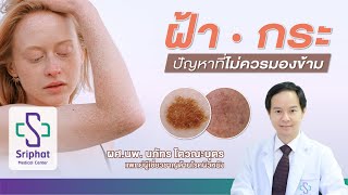 ฝ้า กระ ปัญหาผิวหนังที่ไม่ควรมองข้าม