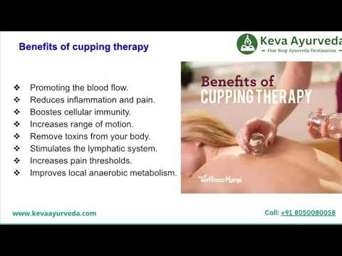 Cupping Therapy #kevaayurveda #cupping