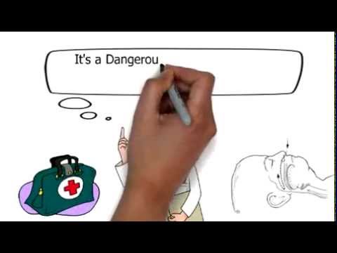 The Best Sacramento Sleep Apnea Treatment?