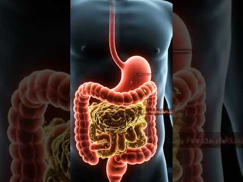 "What Happens Inside Your Body After Eating Fast Food- Constipation Explained". AI Health Journey..!