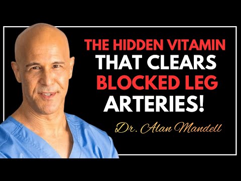 Over 60? Best Vitamins for Seniors Reduce Swelling, Prevent Blood Clots & Strengthen Legs |  Mandell