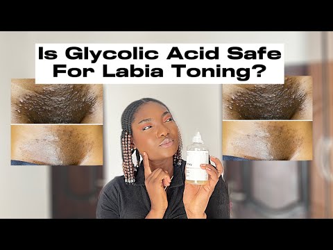 Can you use The Ordinary Glycolic Acid Toning Solution on your Lab!a?Dark inner thighs the ordinary.