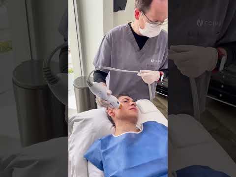 Thermage with Dr.de la Fuente