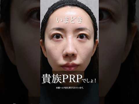 【ほうれい線治療】ほうれい線には貴族PRP#ほうれい線 #美容整形 #美容 #shorts