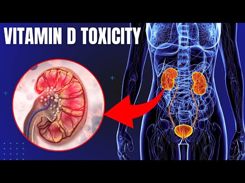 5 Warning Signs You Overdose on Vitamin D | Vitamin D Toxicity Symptoms