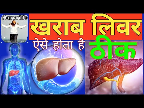 liver ko strong kaise banaye, liver kharab hone ke lakshan/ liver ko kaise theek Karen/liver problem