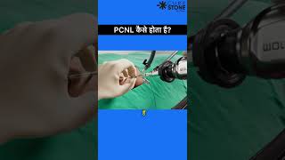 How PCNL is done | Percutaneous nephrolithotomy | Kidney stone treatment | # kidney stone