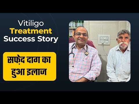 Vitiligo Treatment | Leucoderma Treatment | सफ़ेद दाग का इलाज | सफेद दाग कैसे मिटाएं