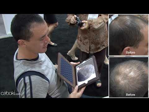 Caboki Hair Fiber - Reviews - Caboki Hair Fiber In Pakistan