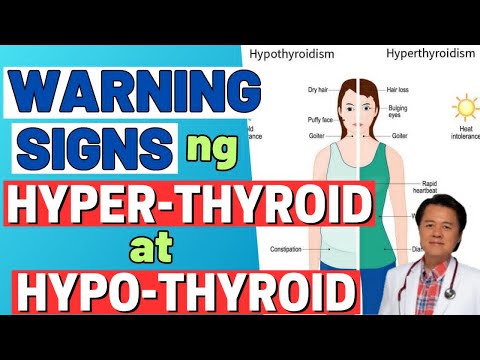 Warning Signs ng Hyper-thyroid at Hypo-thyroid.by Doc Willie Ong (internist and Cardiologist)