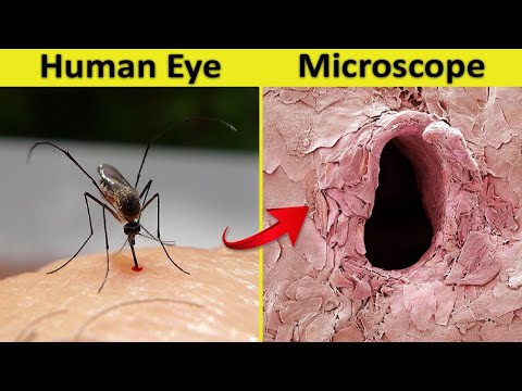 এগুলো শুধুমাত্র মাইক্রোস্কোপে দেখা যায়- অবাক কান্ড | Things You Can See Only Under Microscope