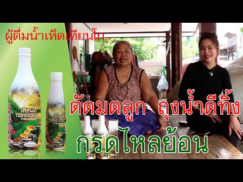 ตัดมดลูกทิ้ง ไม่มีถุงน้ำดี เป็นกรดไหลย้อน