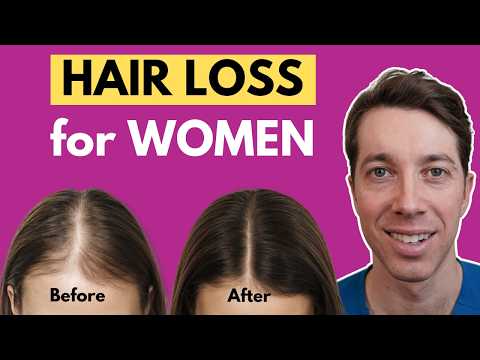 How to Treat Female Hair Loss | Hair Surgeon Advice