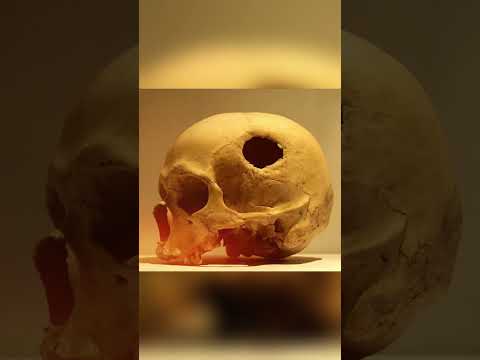 Ancient Surgeon Master | The Ancient Inca | Strange facts you never knew P.35 #shorts