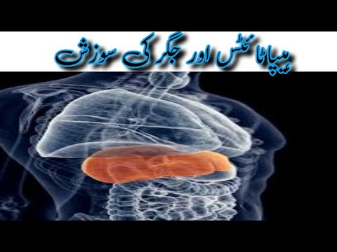 ہیپاٹائٹس اور جگر کی سوزش || Health tips home