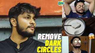 How to REMOVE DARK CIRCLES NATURALLY | 5 Best Home Remedies for Dark Circles
