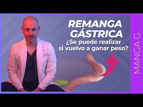 ¿Remanga Gástrica si Vuelvo a Ganar Peso?