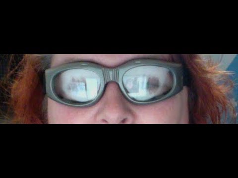 Post LASIK goggle for night dry eye