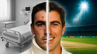 From Career Ending Injuries to World's Best Fast Bowler | The Story of Pat Cummins