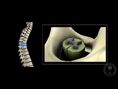 Neuroanatomie - La moelle épinière