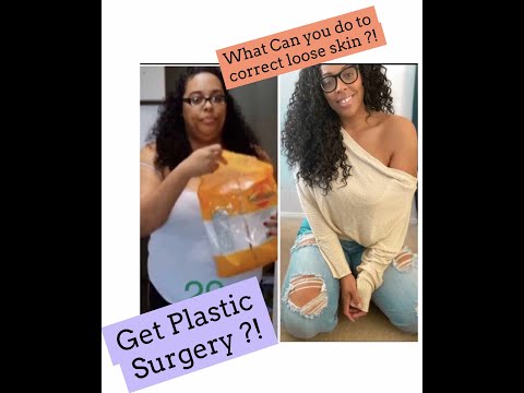 SIDE EFFECTS OF WEIGHT LOSS, LOOSE SKIN! HOW TO CORRECT IT ? GETTING PLASTIC SURGERY IS AN OPTION !