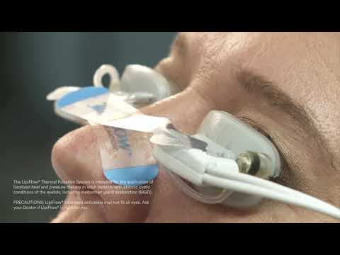 MGD and LipiFlow