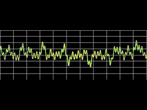 Periodontal Diseases - Rife Frequencies