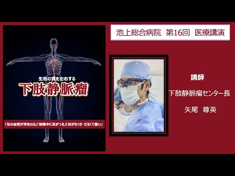 生活の質を左右する下肢静脈瘤〈池上総合病院 公開講座〉