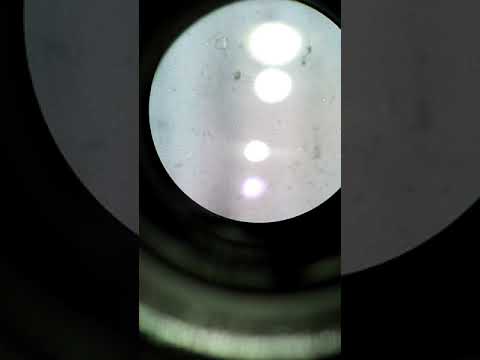 semen analysis normal