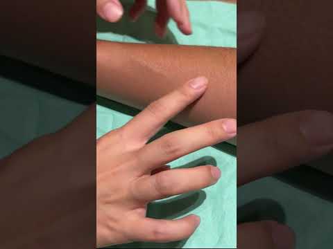 #shorts #infusion #route establishment #peripheral venous access establishment #blood sampling #n...