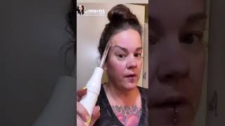Is the high-frequency treatment safe?