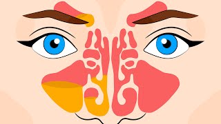 How to unclog your sinuses and clear a stuffy nose instantly!