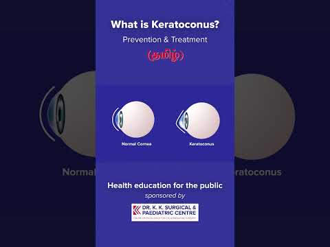 What is Keratoconus? | Prevention & Treatment for Keratoconus | Dr. Kavithalakshmi | #shorts
