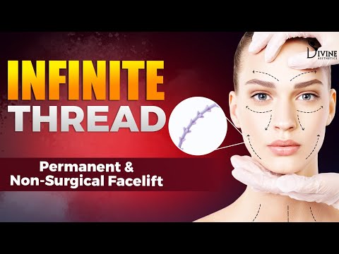 Infinite Thread: Permanent & Non-Surgical Facelift Procedure | Dr Amit Gupta