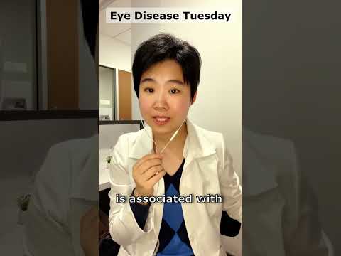 Keratoconus