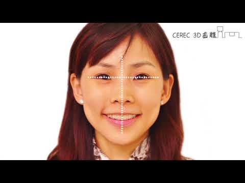 【品適牙醫】高雄3D全瓷牙 CEREC 3D齒雕 完美全瓷修復-沈坤男院長推薦