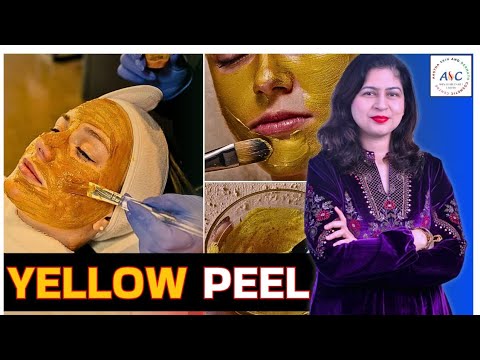 Yellow Peel Treatment for Pigmentation, Wrinkles | Anti-Ageing Glow Peel by Dr Cheena Langer, Jammu